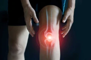 Home Remedies for Joint Pain and Stiffness
