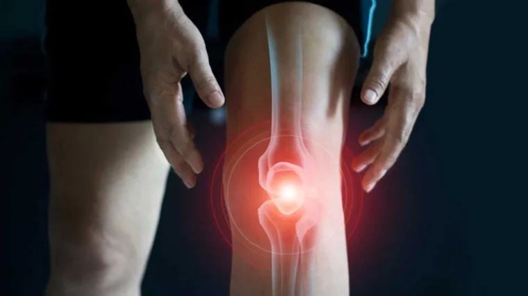 Home Remedies for Joint Pain and Stiffness
