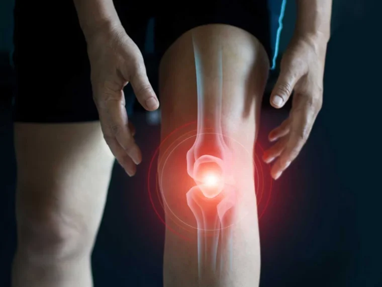 Home Remedies for Joint Pain and Stiffness