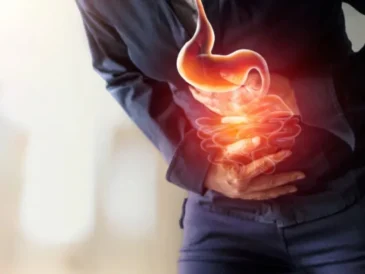 Home remedies for acidity